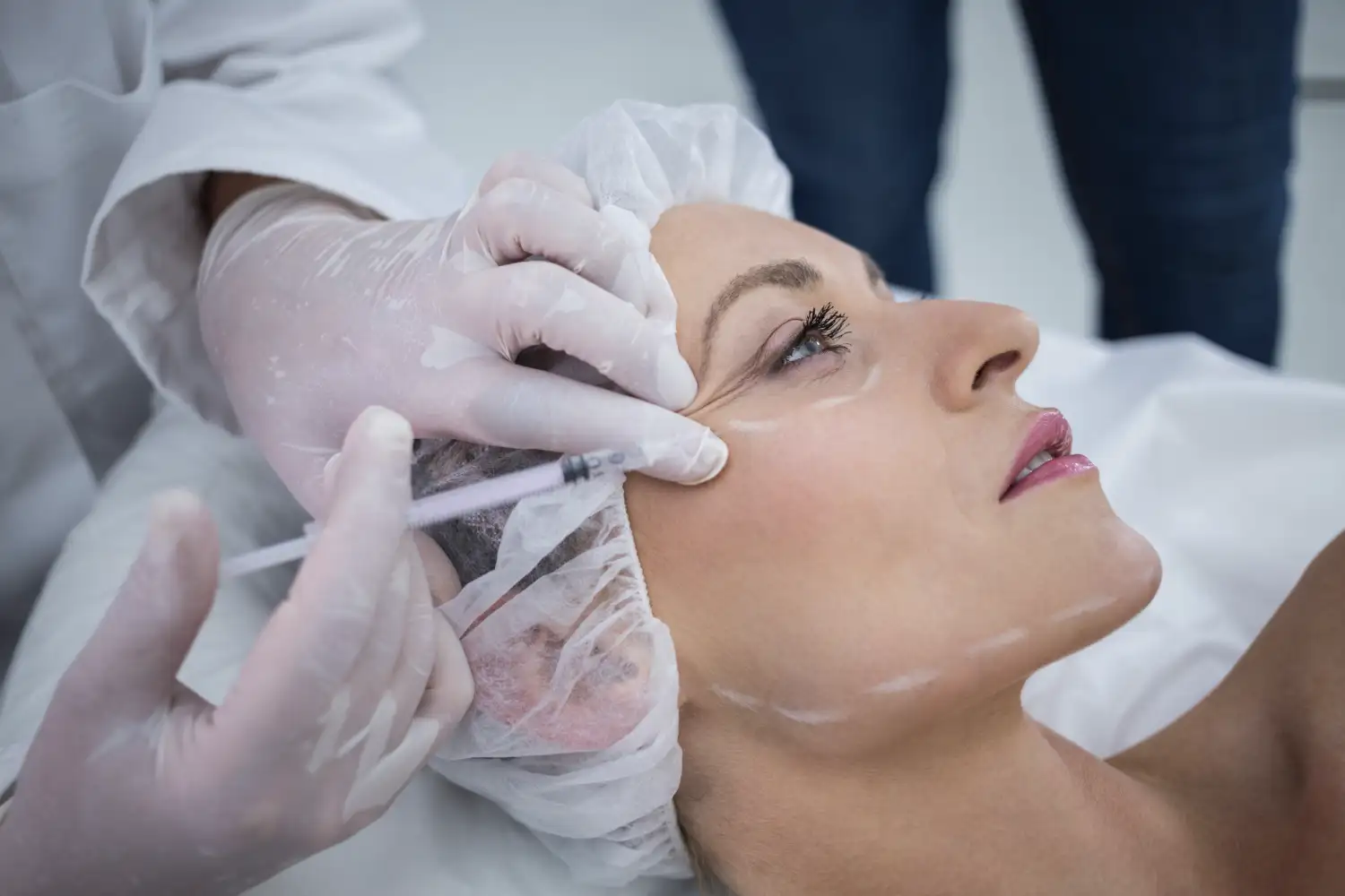 armonización facial con botox