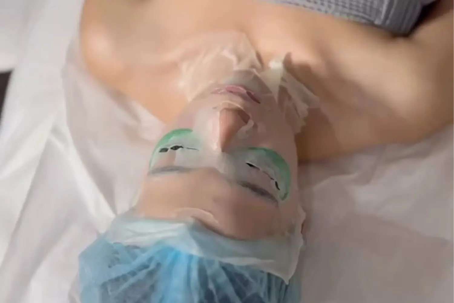 Medicina estética preventiva: por qué cuidarte hoy marca la diferencia mañana