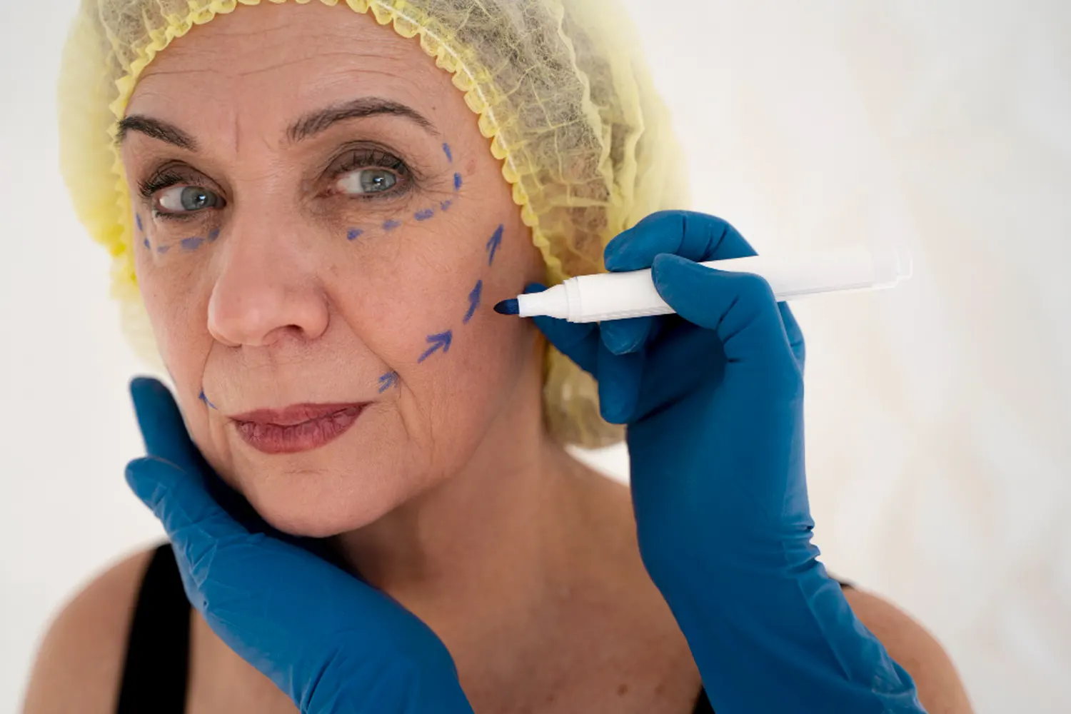 Bioestimulación facial: rejuvenece tu piel sin cambiar tu expresión